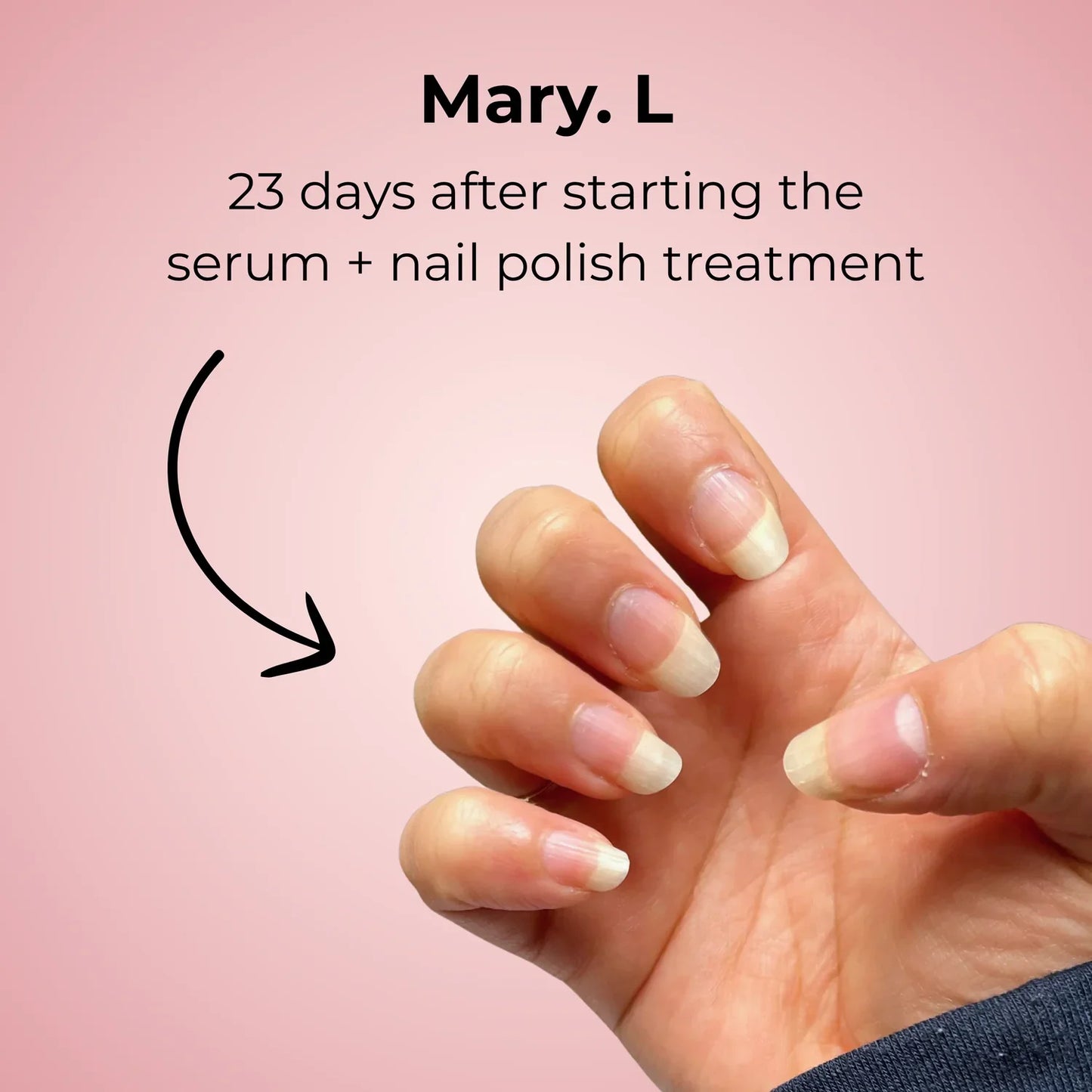 Final 1 Hours: 60% OFF🔥 Nail Growth Serum