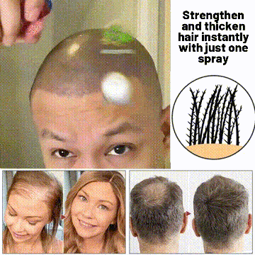 🌿LAST DAY PROMOTION - 70% OFF🌿 HZA™ Natural Hair Regrowth Spray